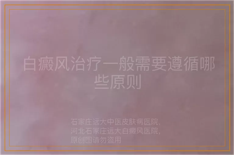 白癜风治疗一般需要遵循哪些原则