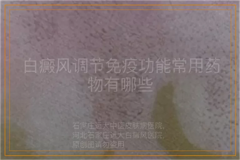 白癜风调节免疫功能常用药物有哪些