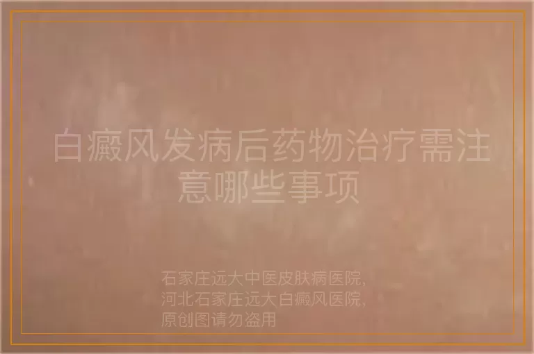 白癜风发病后药物治疗需注意哪些事项