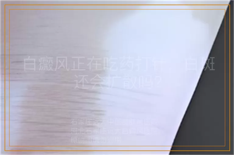白癜风正在吃药打针，白斑还会扩散吗？