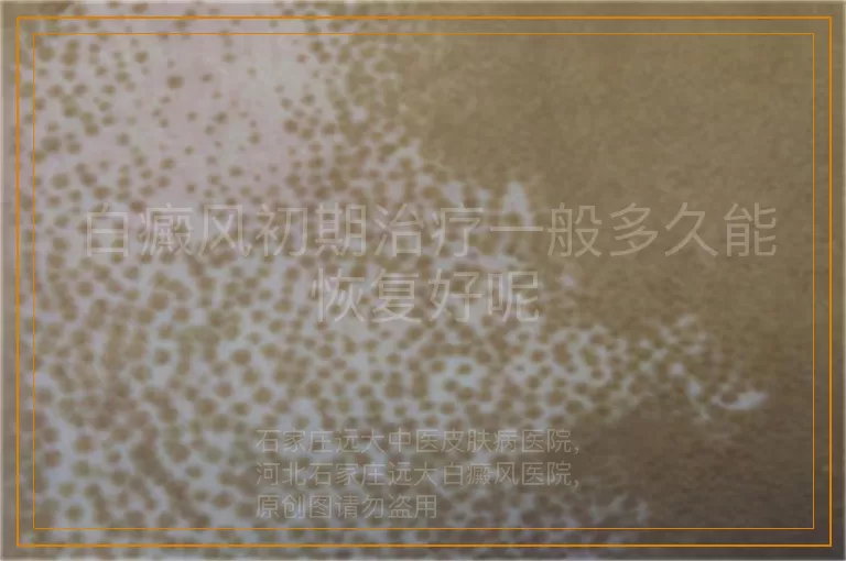 白癜风初期治疗一般多久能恢复好呢