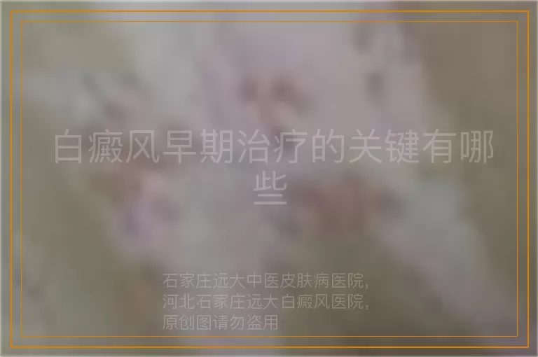 白癜风早期治疗的关键有哪些