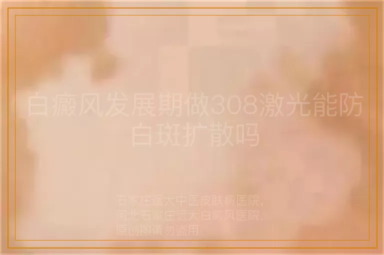 白癜风发展期做308激光能防白斑扩散吗