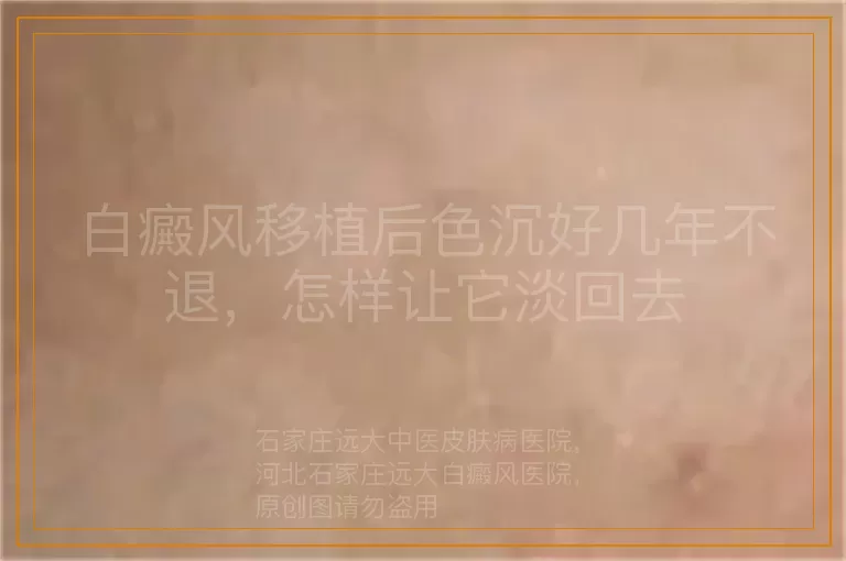 白癜风移植后色沉好几年不退，怎样让它淡回去