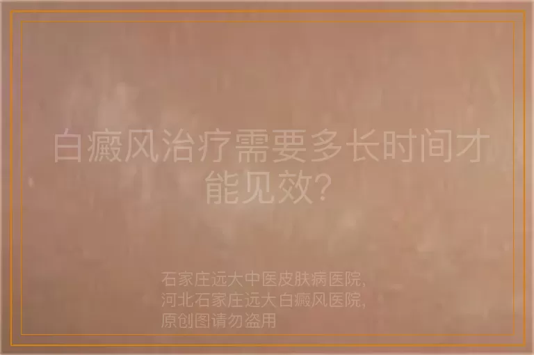 白癜风治疗需要多长时间才能见效？