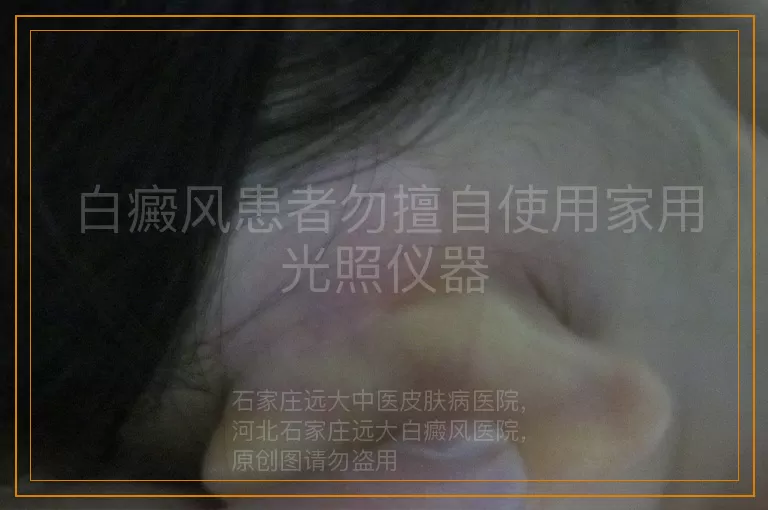 白癜风患者勿擅自使用家用光照仪器