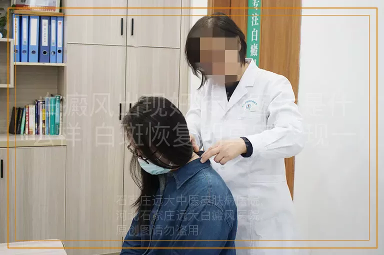 白癜风出现好转的图片是什么样 白斑恢复期真实表现一看就懂