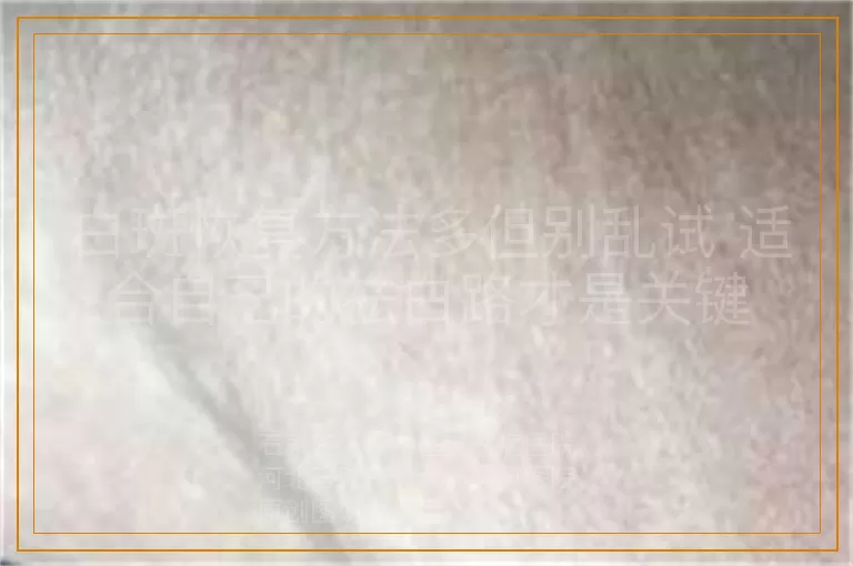 白斑恢复方法多但别乱试 适合自己的祛白路才是关键