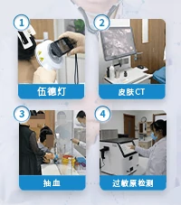 白斑病白癜风