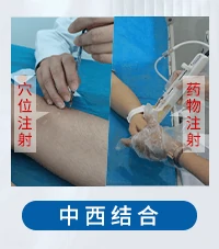 白癜风特色疗法