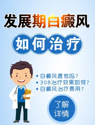 白癜风如何治疗